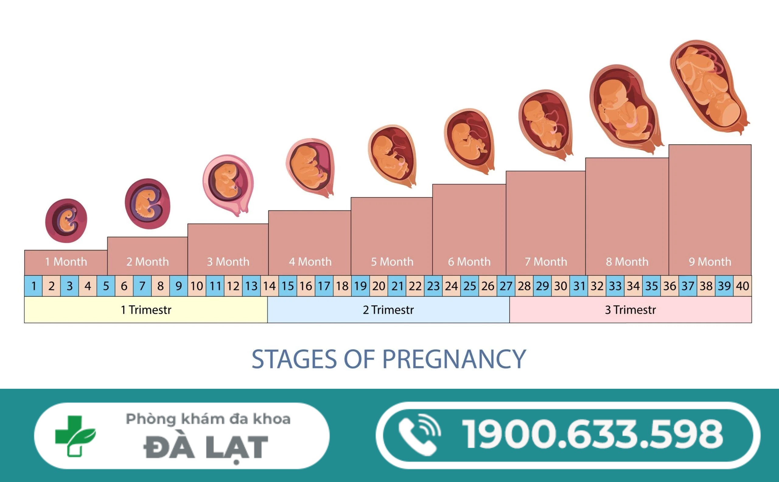 Hình ảnh minh họa